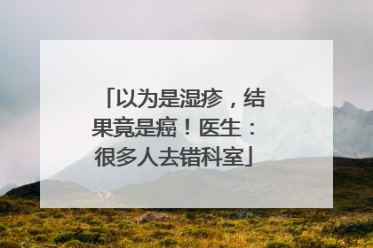 以为是湿疹，结果竟是癌！医生：很多人去错科室